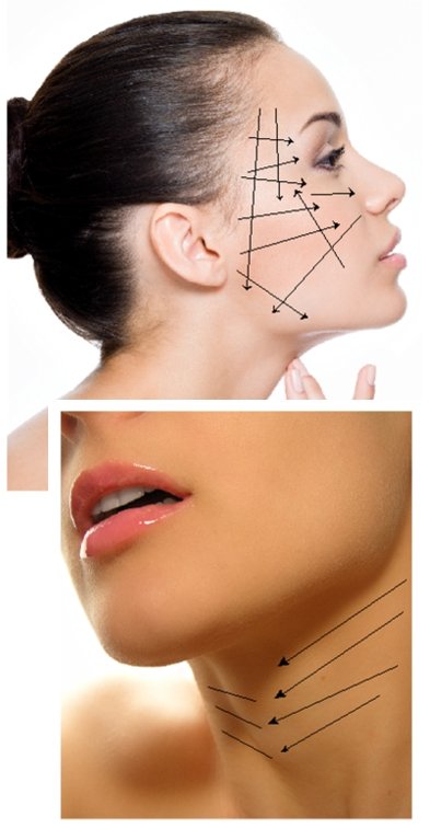 Hilos Reabsorbibles Pdo imagen 2